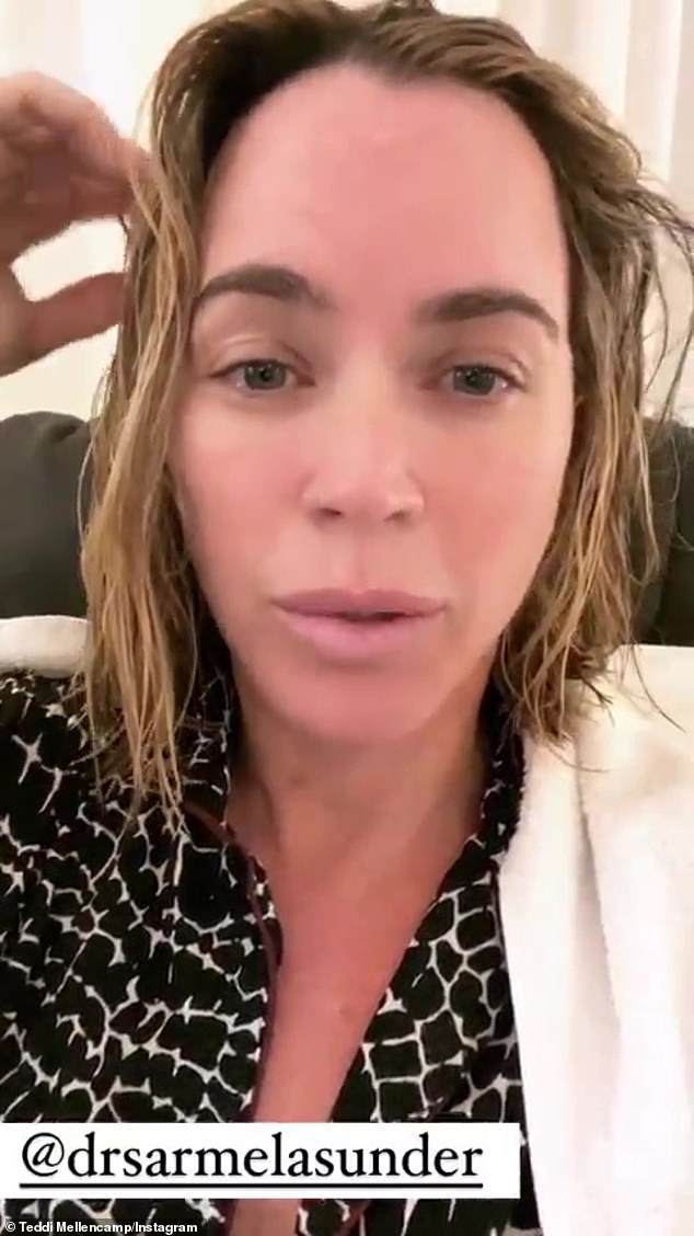 Post-op: Teddi Mellencamp revealed on social media this week that she had a neck lift because she felt 'insecure' with how she looked in profile